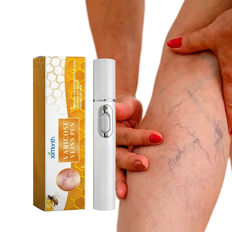 Lampshade Therapy Leg Repair Pen Relieves Leg Bulge Discomfort Improving Blood Circulation Varicose Veins Pen Skin Care Product