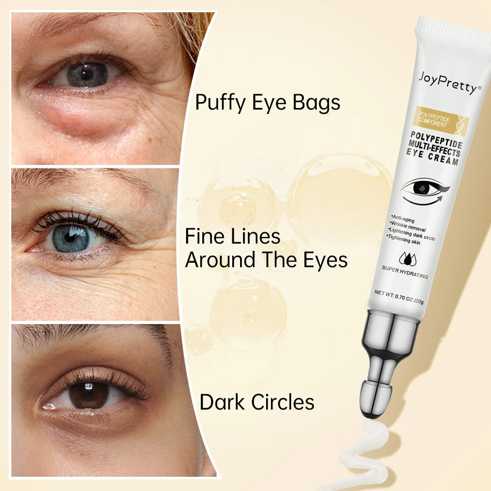 JoyPretty Anti Dark Circles Eye Cream Peptide Remove Bags Under The Eyes Lifting Fine Lines Eye Serum Skin Care Beauty Health