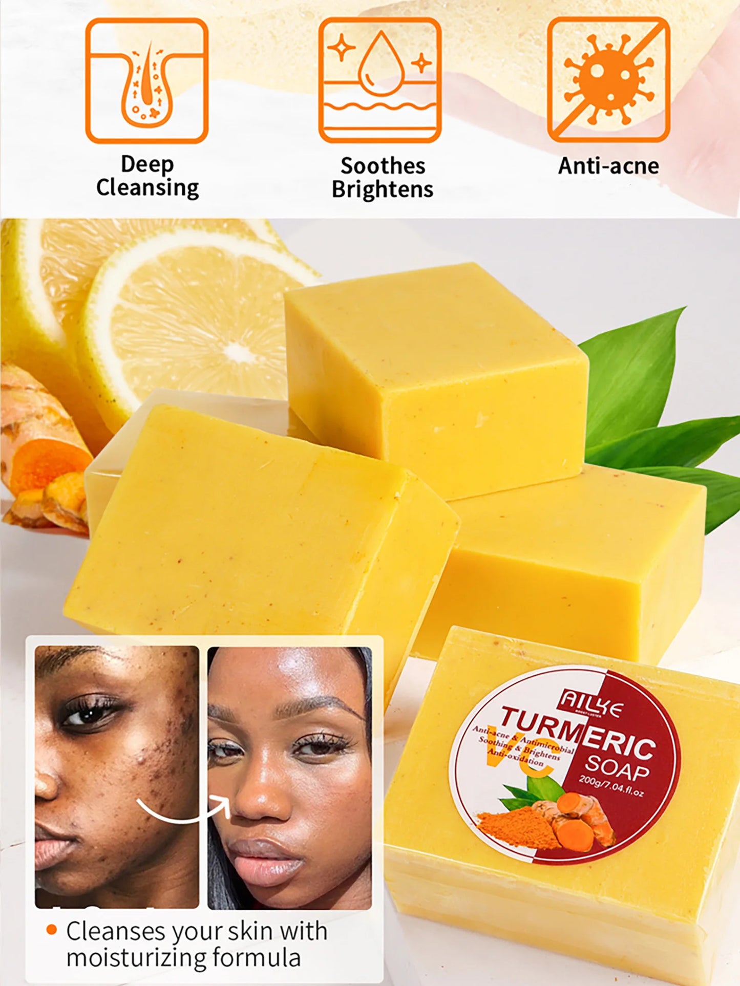 AILKE Turmeric Soap, Whiten, Remove Acne, Oil Control, Brightening, Clean Skin, Deeply Exfoliates, Even Skin Tone