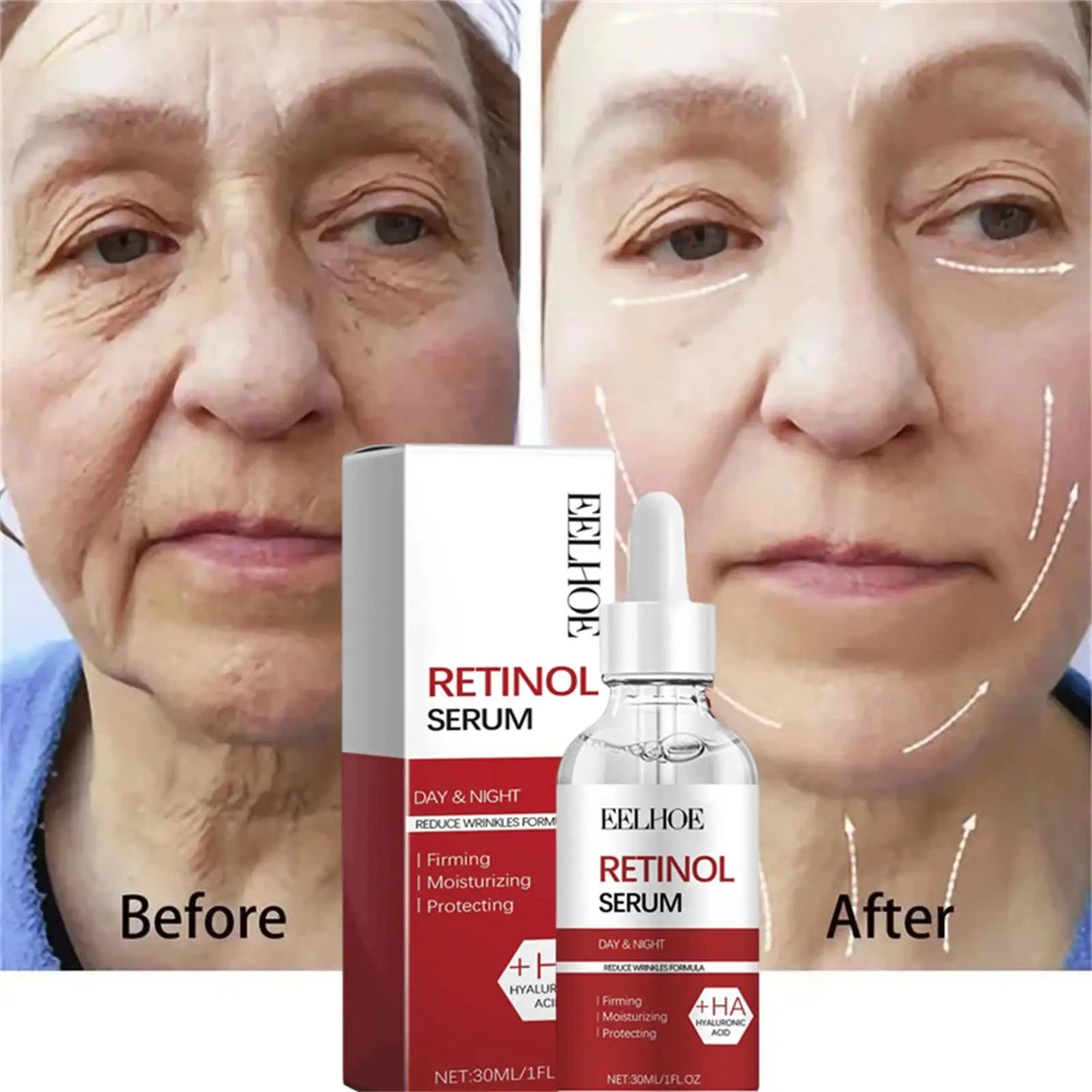 Retinol Wrinkle Remover Face Set Instant Firming Lifting Anti-Aging Serum Fade Fine Lines Whitening Korean Skin Care Products