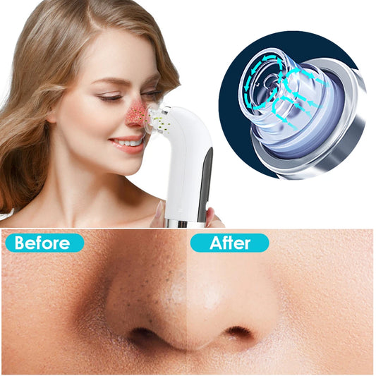 Face Care Bubble Blackhead Remover Vacuum Face Deep Pore Nose Cleaner Suction Black Dots Beauty Products Facial Cleaning Tool