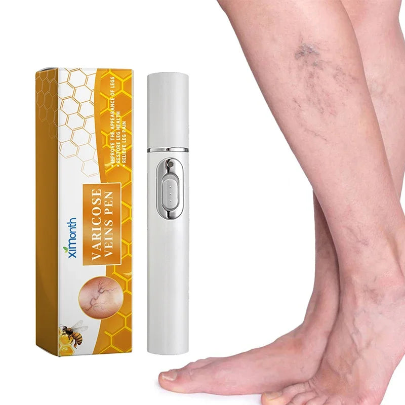 Laser Veins Varicose Pen Reduce Legs Imcomfortable Improve Blood Circulation Laser Therapy Varicose Veins Pen Skin Care Product