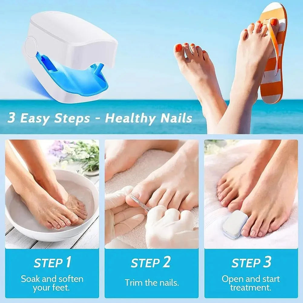 Nail Fungus Laser Treatment Device Repair Toenail Fingernail Effectively Remove Fungus Treat Onychomycosis Essential Oil