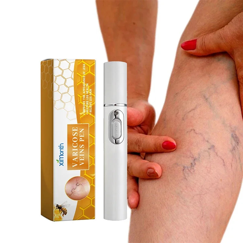 Laser Veins Varicose Pen Reduce Legs Imcomfortable Improve Blood Circulation Laser Therapy Varicose Veins Pen Skin Care Product