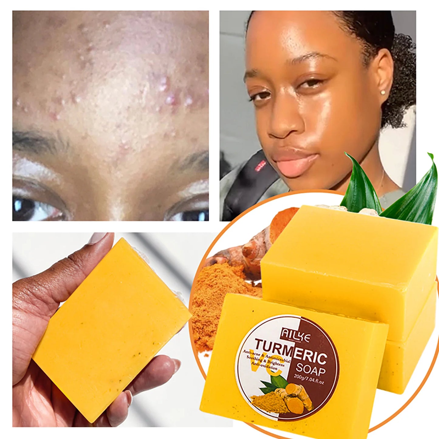 AILKE Turmeric Soap, Whiten, Remove Acne, Oil Control, Brightening, Clean Skin, Deeply Exfoliates, Even Skin Tone