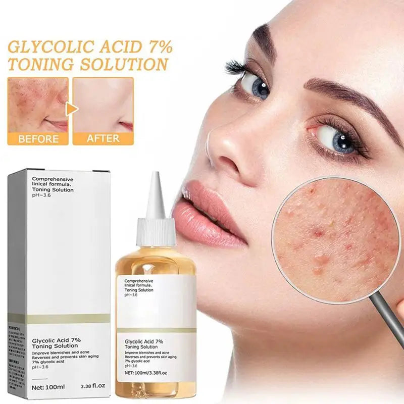 Glycolic Acid 7% Toning Solution Facial Care Toner Exfoliator Smoothing Skin Anti Aging Face Toner Solution AcneTreatment Serum