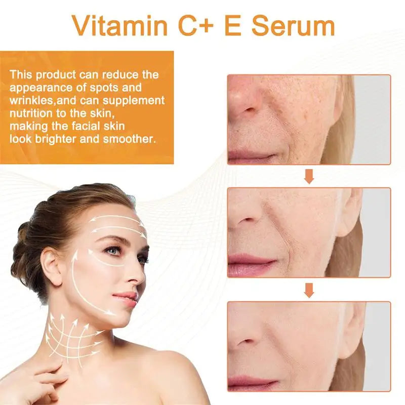 Eelhoe Vitamin C Whitening Serum Remove Dark Spots Whiten Fade Freckles Fine Lines Lifting Firming Anti-aging Brighten Skin Care