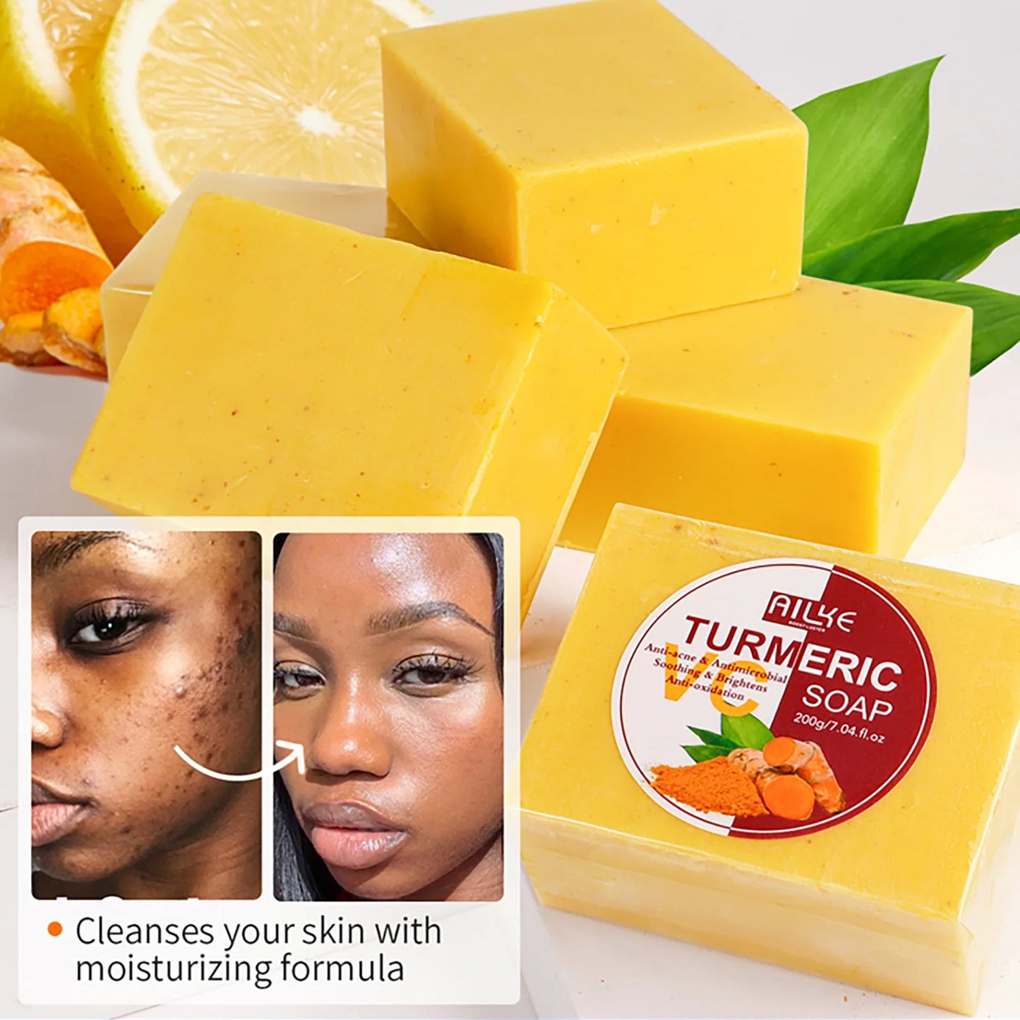 AILKE Turmeric Soap, Whiten, Remove Acne, Oil Control, Brightening, Clean Skin, Deeply Exfoliates, Even Skin Tone