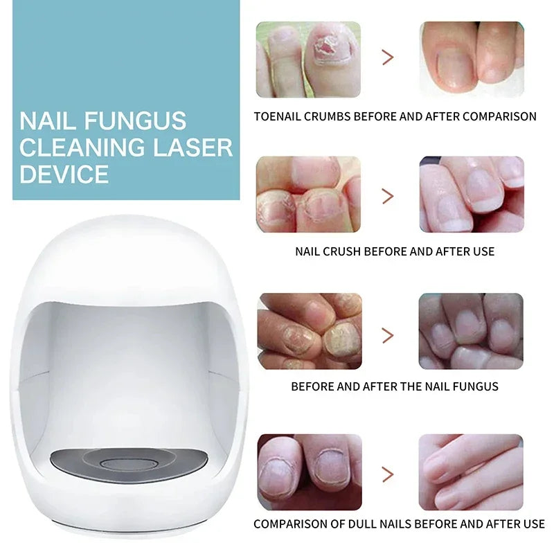 Xiaomi Toenail Nail Fungus Treatment Repair Fingernail Device Toenail Treatment for Foot Nail Fungus Essential Oil Onychomycosis