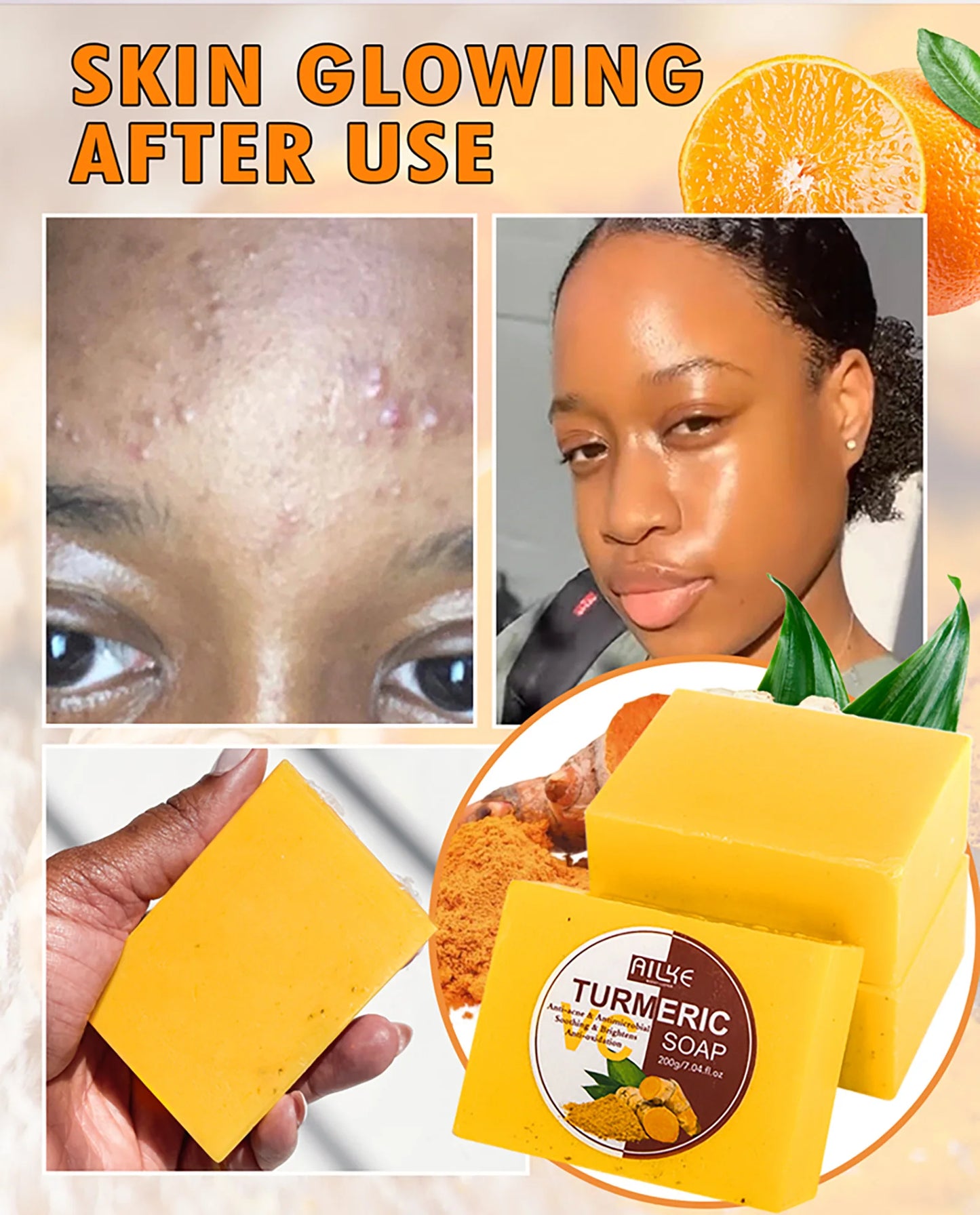 AILKE Turmeric Soap, Whiten, Remove Acne, Oil Control, Brightening, Clean Skin, Deeply Exfoliates, Even Skin Tone