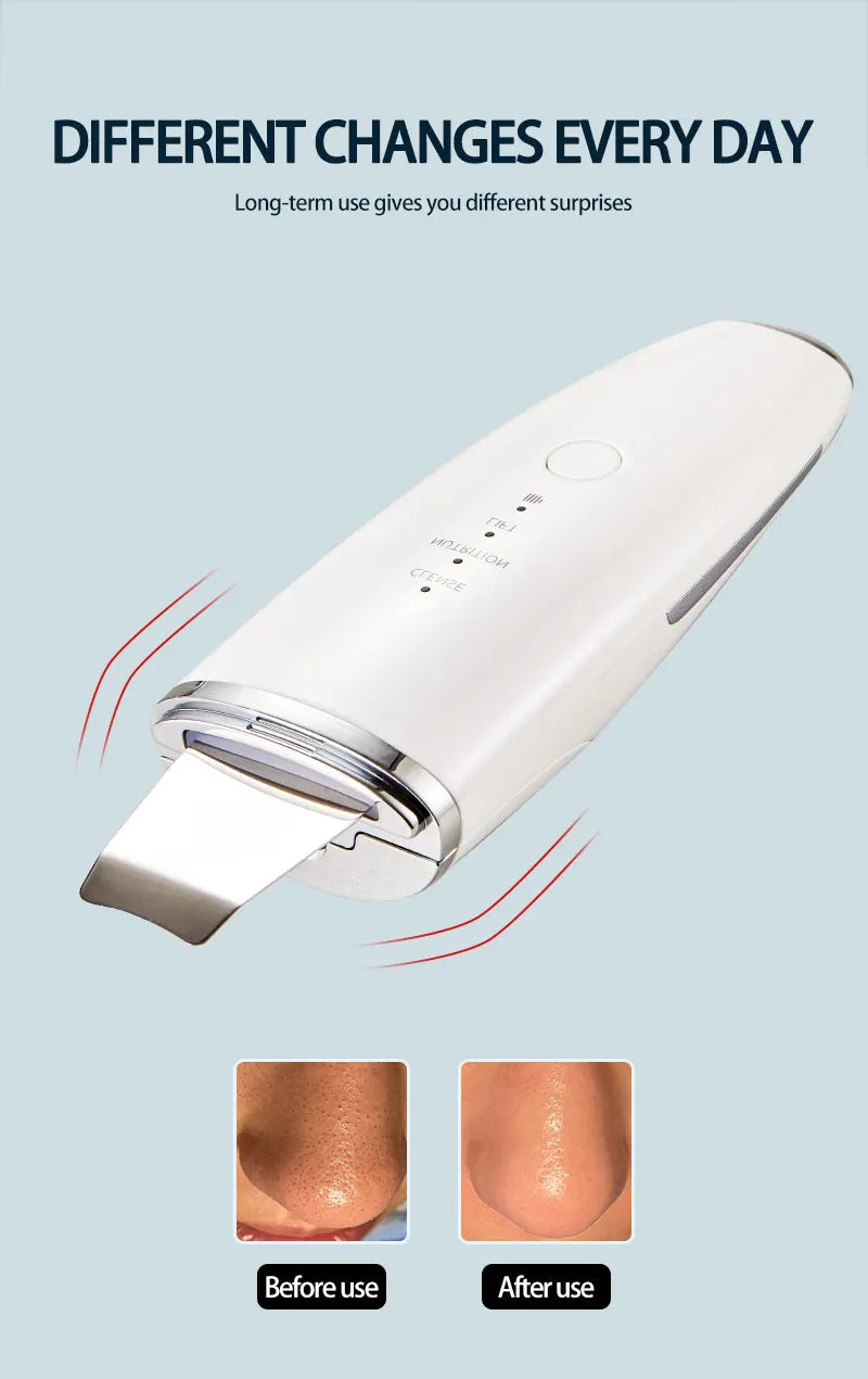 Ultrasonic Skin Scrubber Blackhead Exfoliation Dead Skin Cleansing Spatula Deep Cleansing Scraper Facial Lifting Firming Skincar