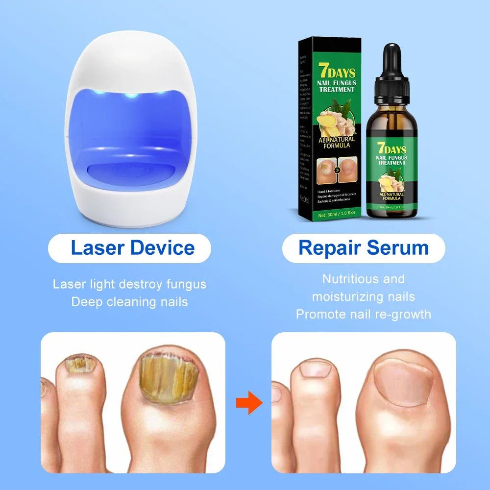 Xiaomi Toenail Nail Fungus Treatment Repair Fingernail Device Toenail Treatment for Foot Nail Fungus Essential Oil Onychomycosis