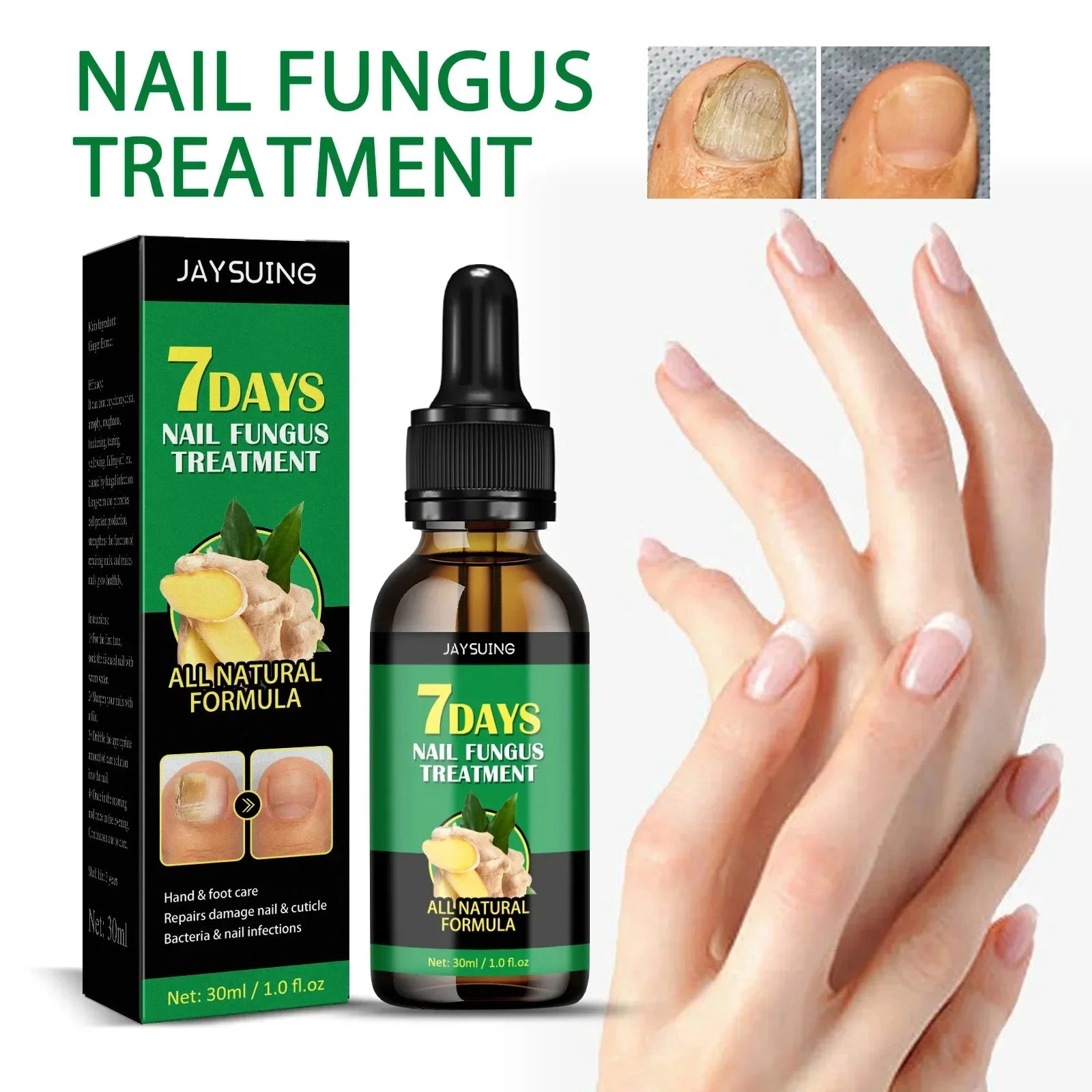 Nail Fungus Laser Treatment Device Repair Toenail Fingernail Effectively Remove Fungus Treat Onychomycosis Essential Oil