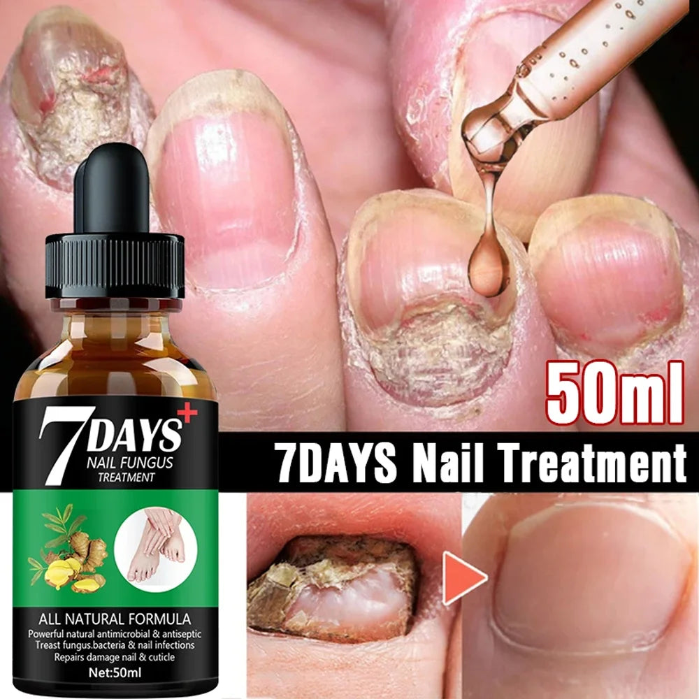 Nail Fungus Laser Treatment Device Repair Toenail Fingernail Effectively Remove Fungus Treat Onychomycosis Essential Oil