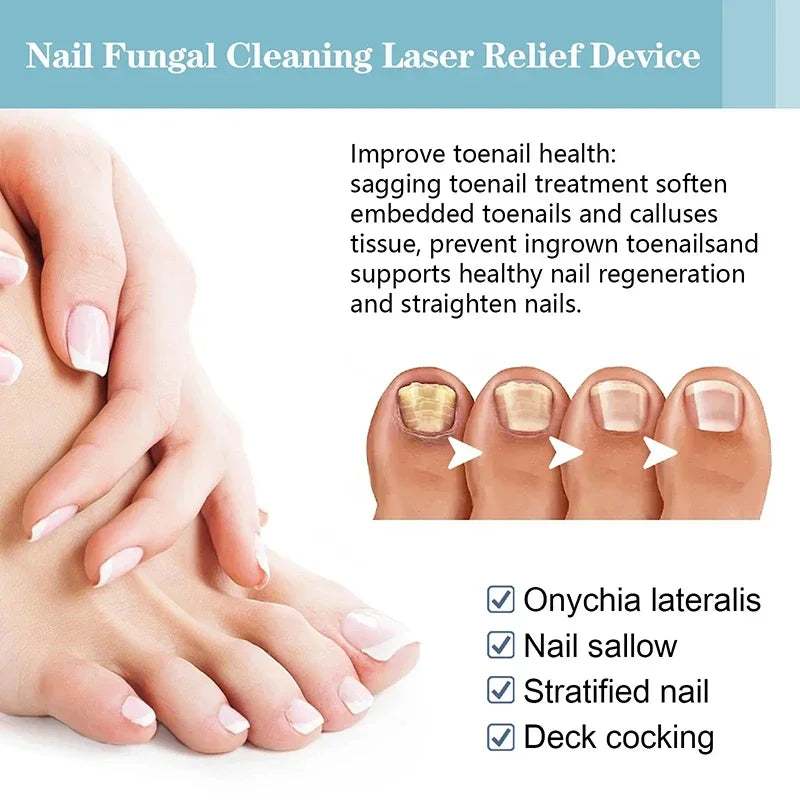 Xiaomi Toenail Nail Fungus Treatment Repair Fingernail Device Toenail Treatment for Foot Nail Fungus Essential Oil Onychomycosis