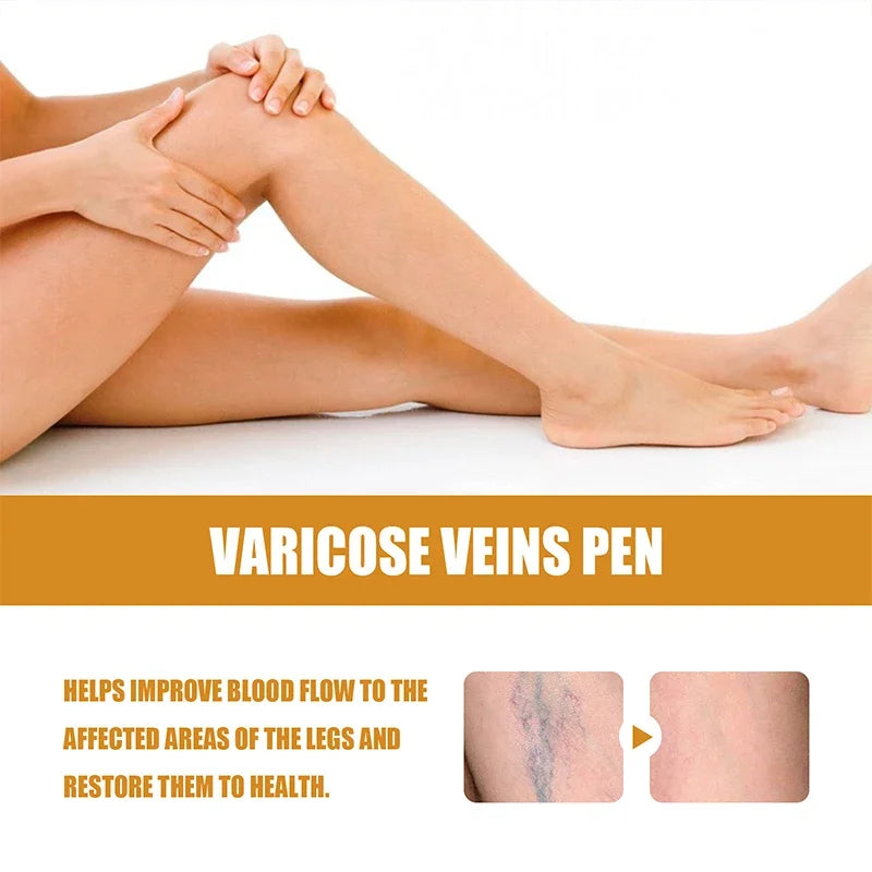 Laser Veins Varicose Pen Reduce Legs Imcomfortable Improve Blood Circulation Laser Therapy Varicose Veins Pen Skin Care Product