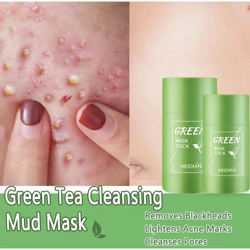 Blackhead Remover Acne Skincare Green Tea Mask Deep Clean Stick Mask Facial Dispel Acne Blemish Shrink Pore Skin Exfoliate Cream