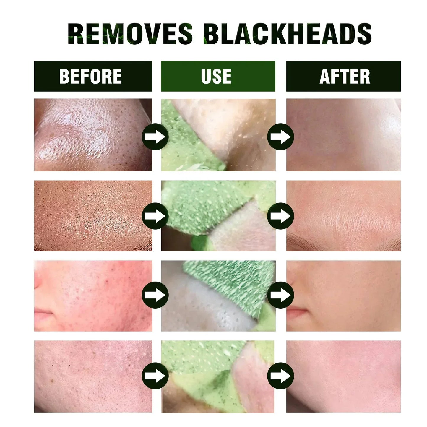 Blackhead Remover Acne Skincare Green Tea Mask Deep Clean Stick Mask Facial Dispel Acne Blemish Shrink Pore Skin Exfoliate Cream