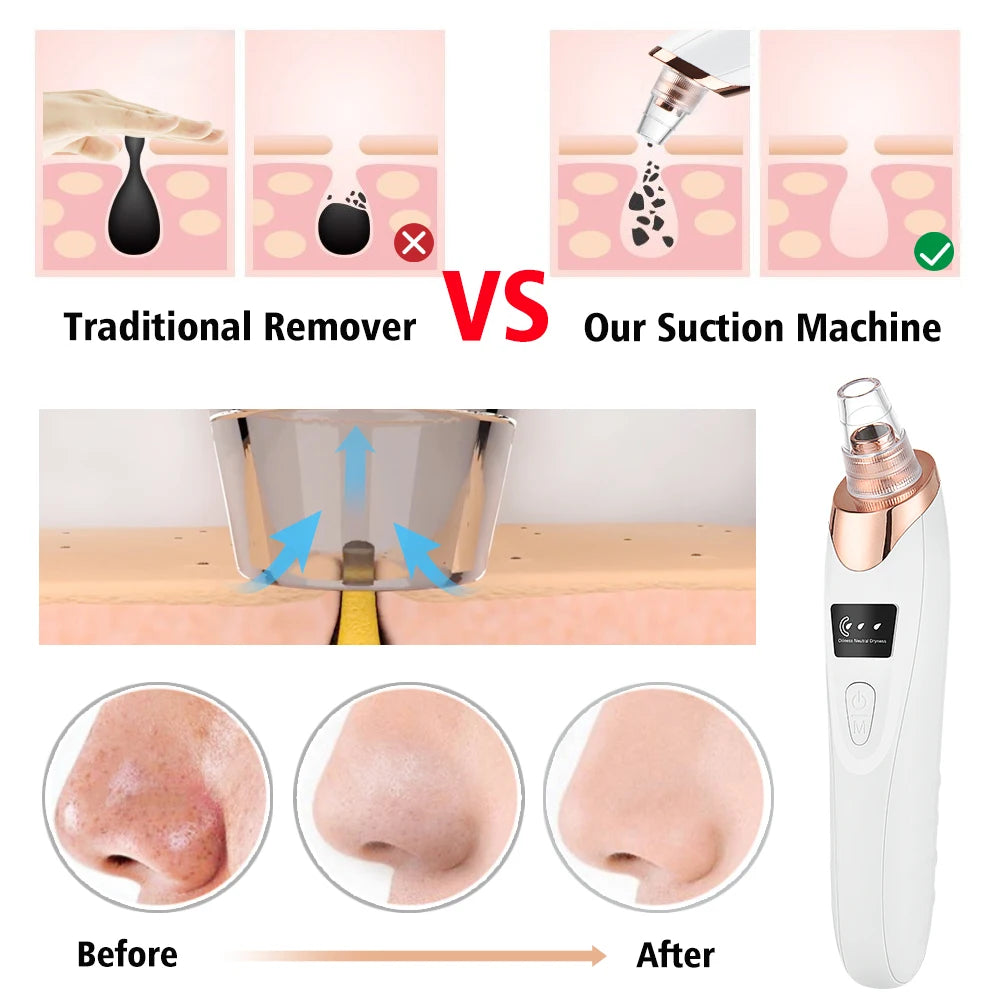 Face Care Bubble Blackhead Remover Vacuum Face Deep Pore Nose Cleaner Suction Black Dots Beauty Products Facial Cleaning Tool