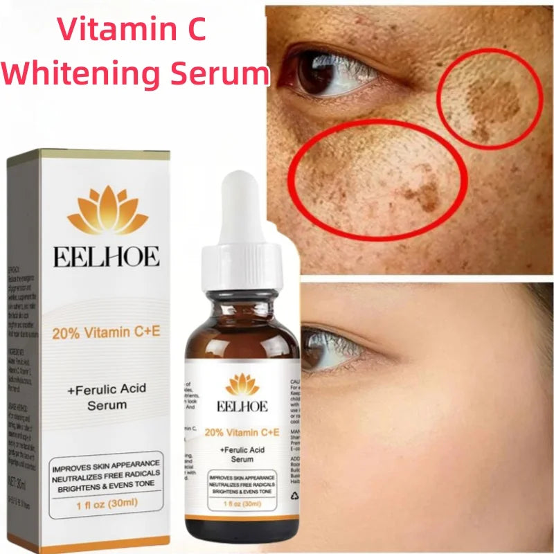 Eelhoe Vitamin C Whitening Serum Remove Dark Spots Whiten Fade Freckles Fine Lines Lifting Firming Anti-aging Brighten Skin Care