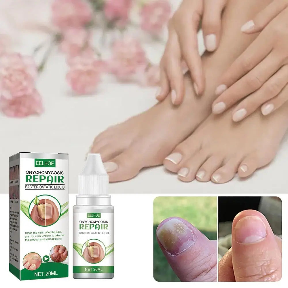 Toenail Anti-infective Nail Repair Solution Gel Hand Foot Nails Care Fungu Removal Nail Repair Drops Restoring Healthy Nails