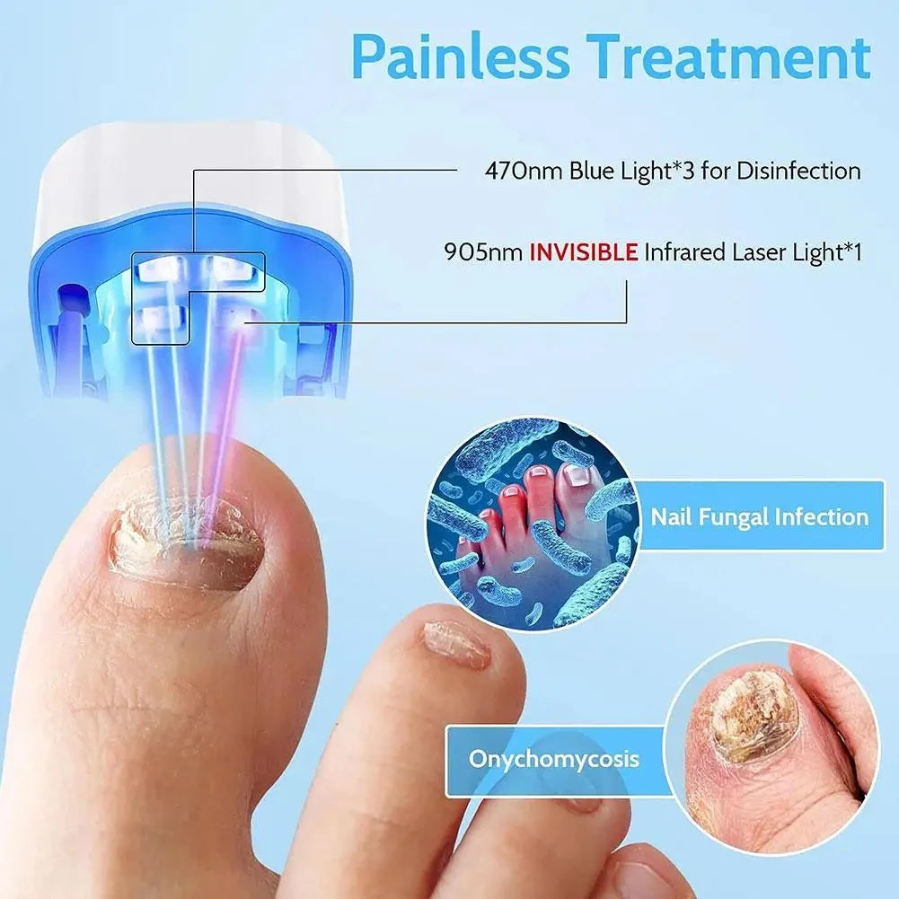 Nail Fungus Laser Treatment Device Repair Toenail Fingernail Effectively Remove Fungus Treat Onychomycosis Essential Oil