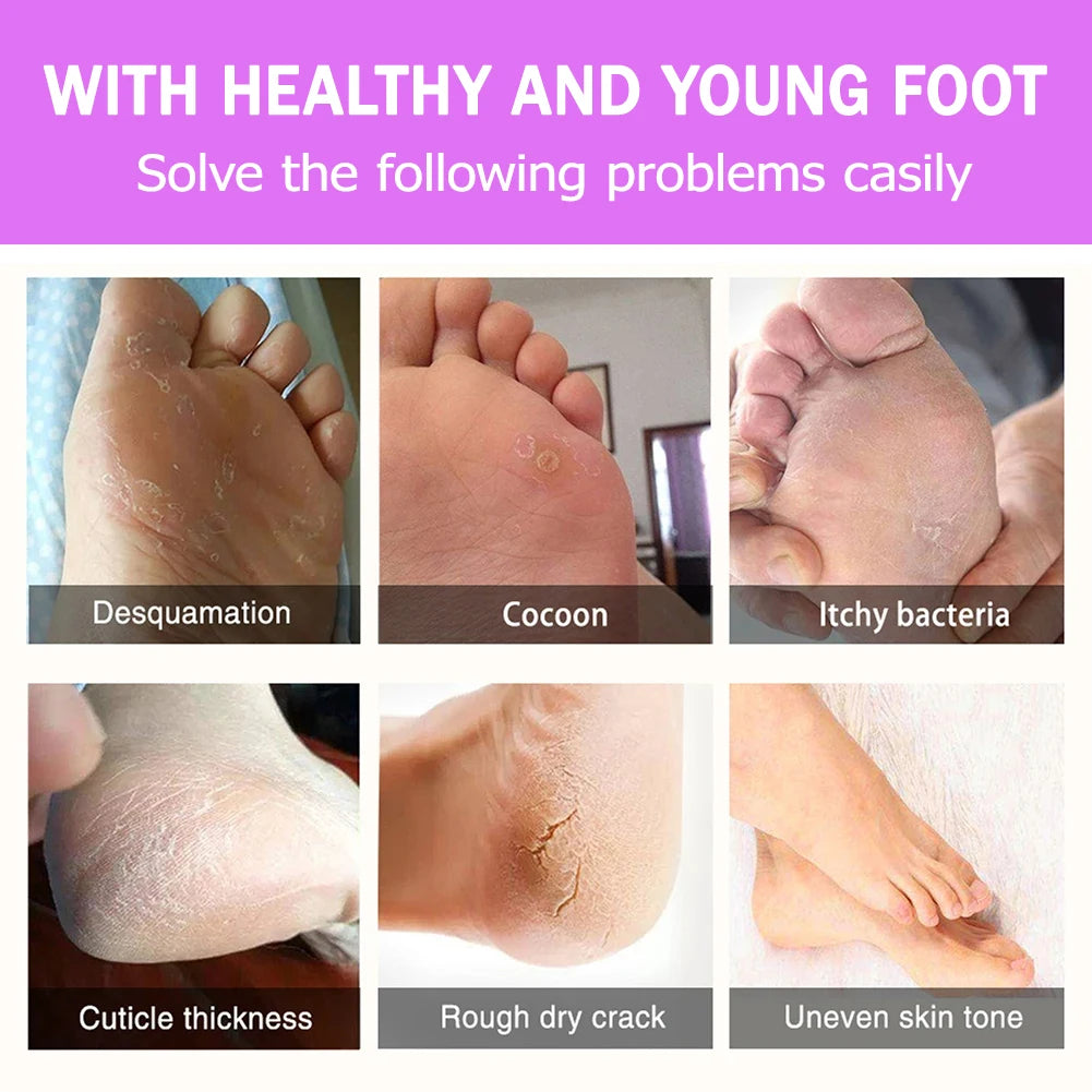 2-10pcs Exfoliating Foot Mask Foot For Remove Dead Skin Calluses Heel Crack Repair Foot Mask Pedicure Socks Foot Skin Care