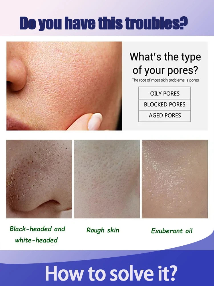 Removing Large Pores Pore Shrinking Serum Face Tightening Repairing Facial Pore Minimizing Moisturizing Skin Care Product