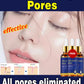 Removing Large Pores Pore Shrinking Serum Face Tightening Repairing Facial Pore Minimizing Moisturizing Skin Care Product