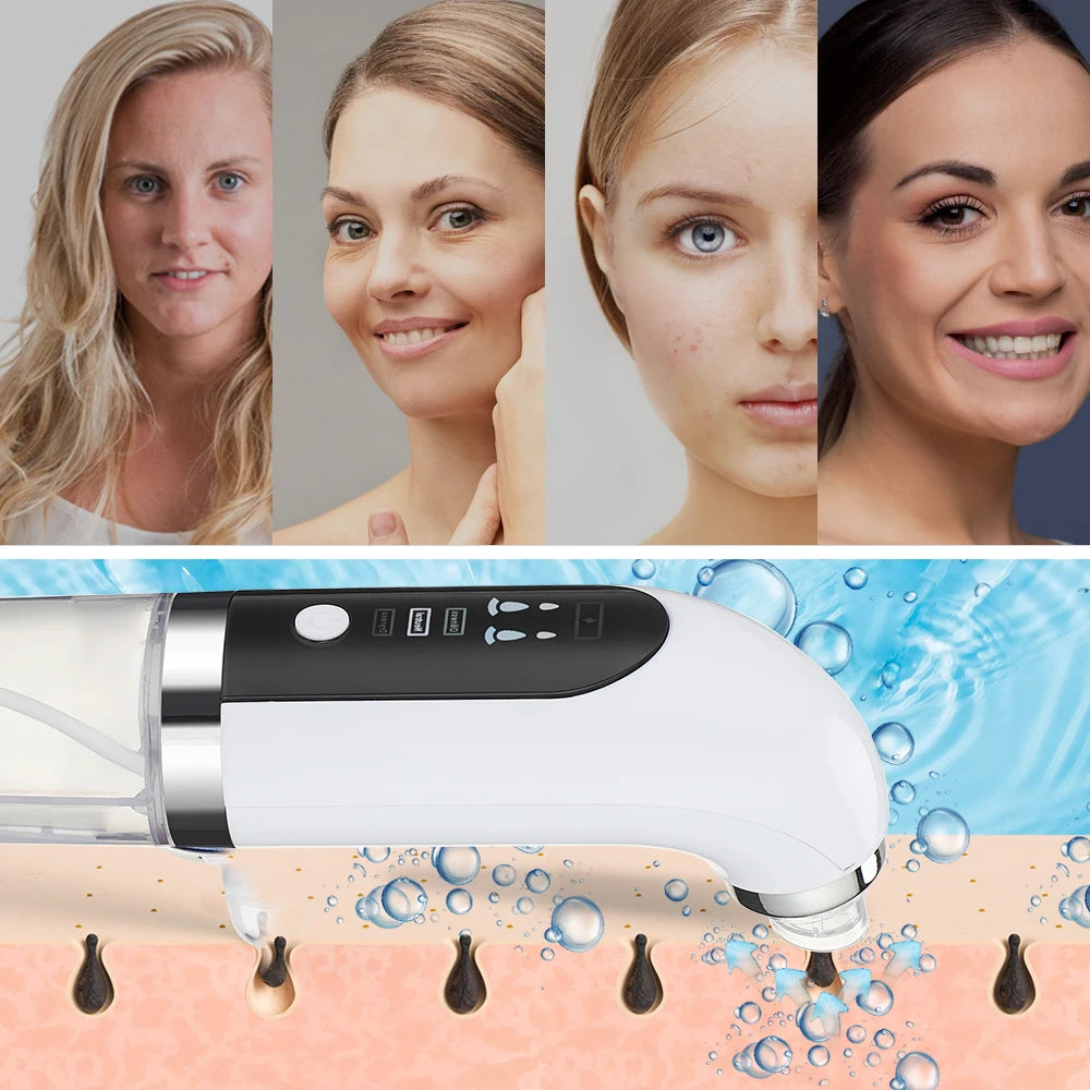 Face Care Bubble Blackhead Remover Vacuum Face Deep Pore Nose Cleaner Suction Black Dots Beauty Products Facial Cleaning Tool